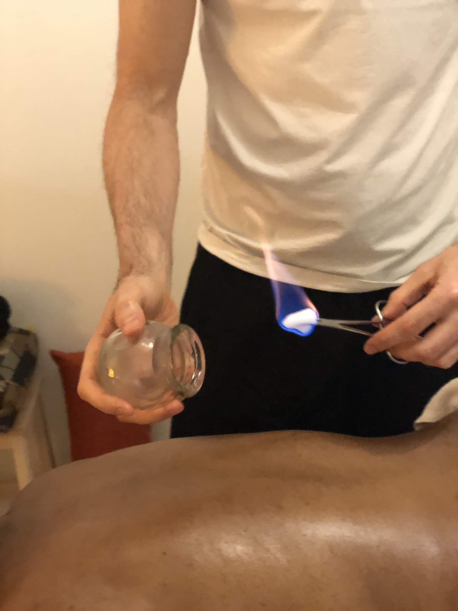 Ventouses_shiatsu_elements